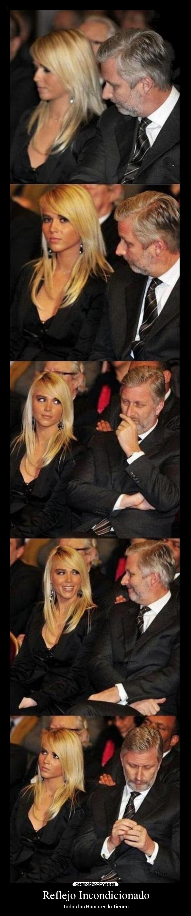 Reflejo Incondicionado - 