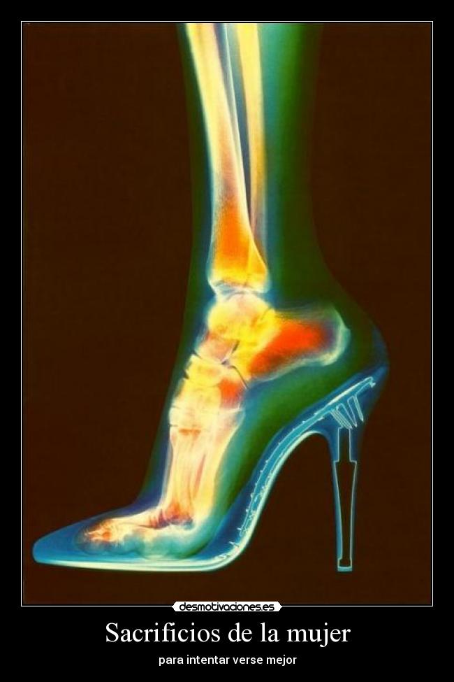 Sacrificios de la mujer -