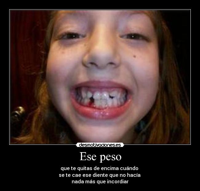 Ese peso - que te quitas de encima cuándo 
se te cae ese diente que no hacía 
nada más que incordiar