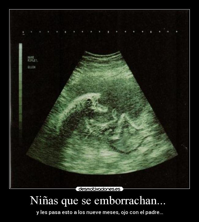 Niñas que se emborrachan...  - 