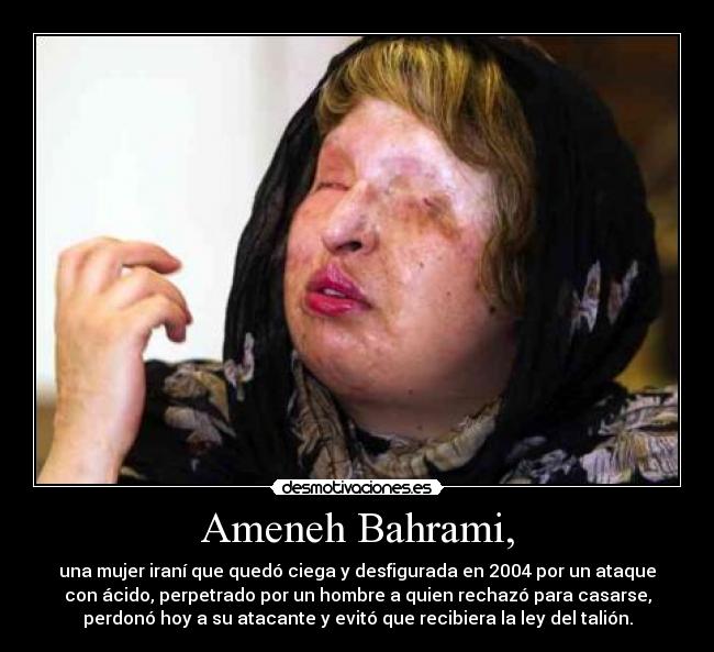 Ameneh Bahrami, - una mujer iraní que quedó ciega y desfigurada en 2004 por un ataque
con ácido, perpetrado por un hombre a quien rechazó para casarse,
perdonó hoy a su atacante y evitó que recibiera la ley del talión.