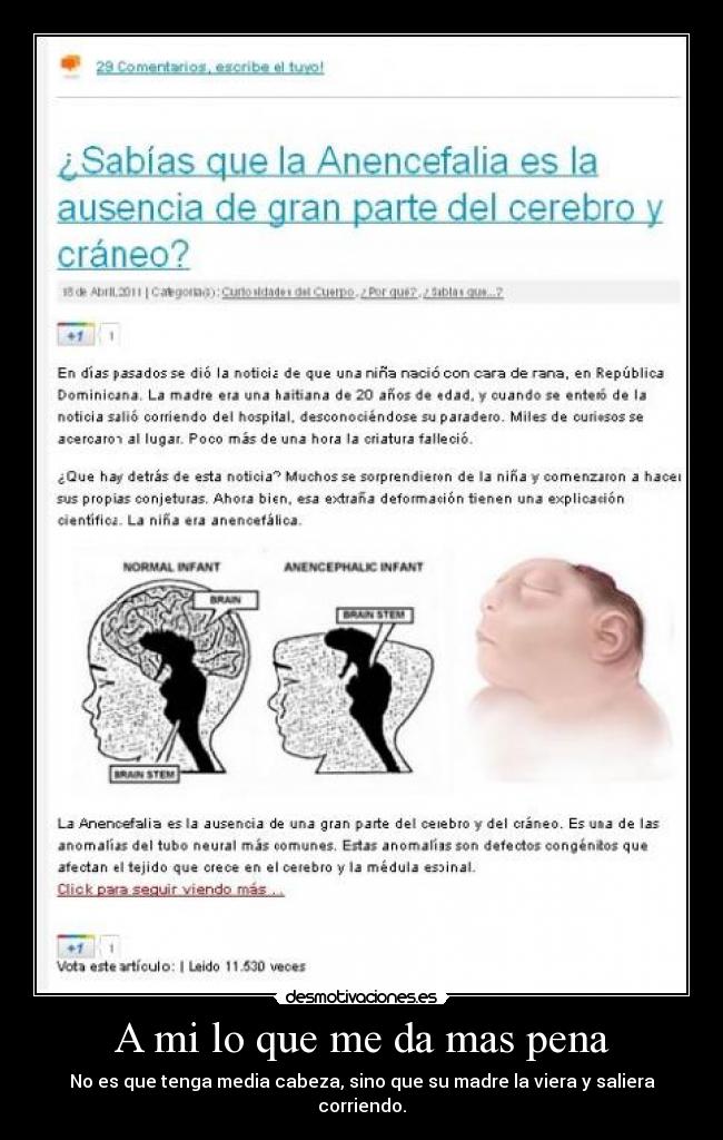 A mi lo que me da mas pena - No es que tenga media cabeza, sino que su madre la viera y saliera corriendo.