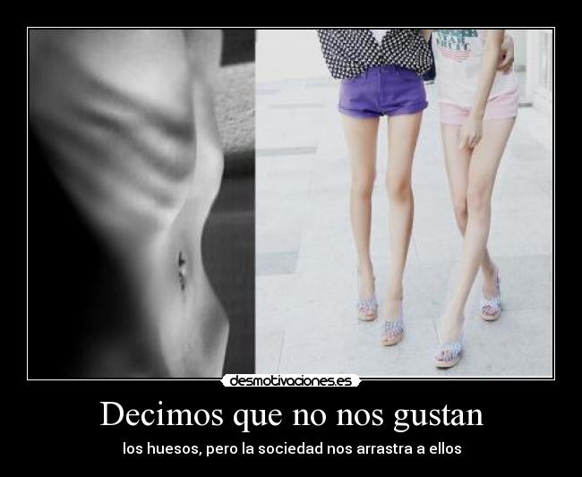 Decimos que no nos gustan -