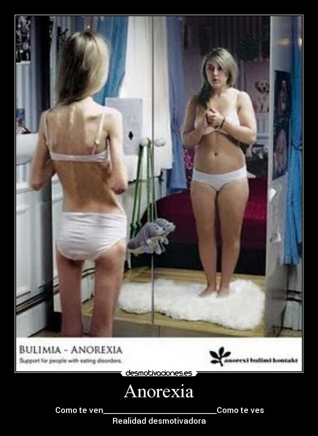 Anorexia - Como te ven_____________________________Como te ves
Realidad desmotivadora