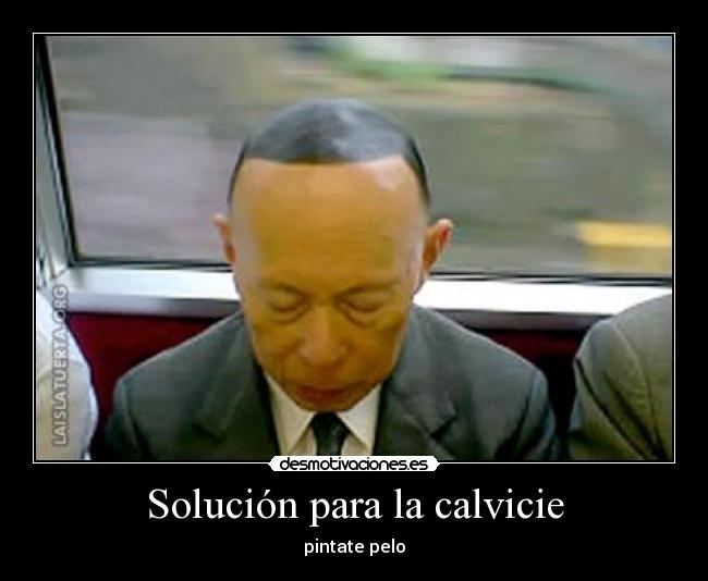 Solución para la calvicie - 