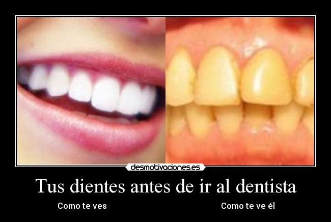 Tus dientes antes de ir al dentista - Como te ves                                                        Como te ve él