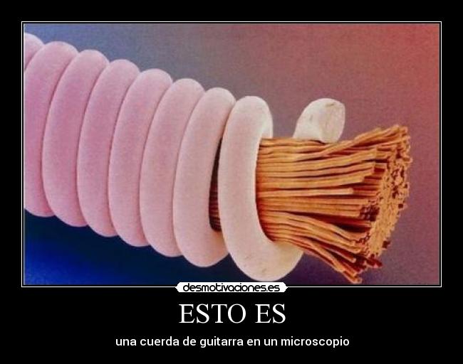 ESTO ES - 