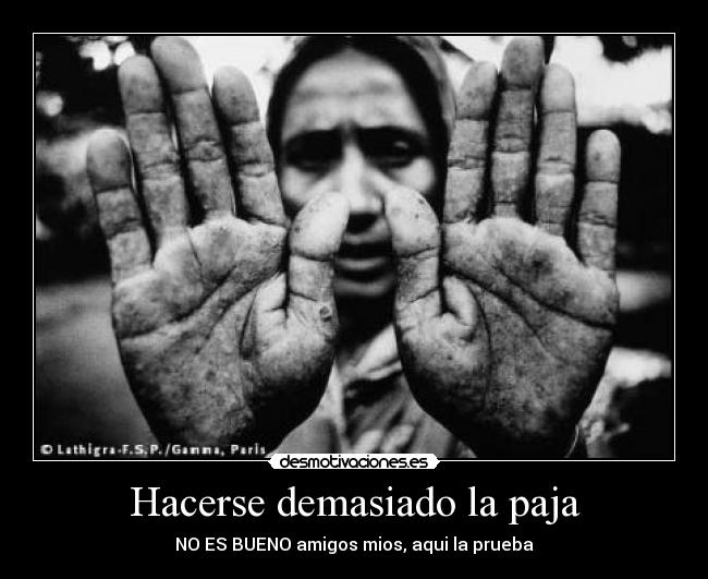 Hacerse demasiado la paja - NO ES BUENO amigos mios, aqui la prueba