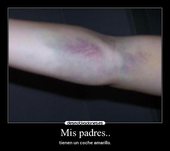 Mis padres.. - 