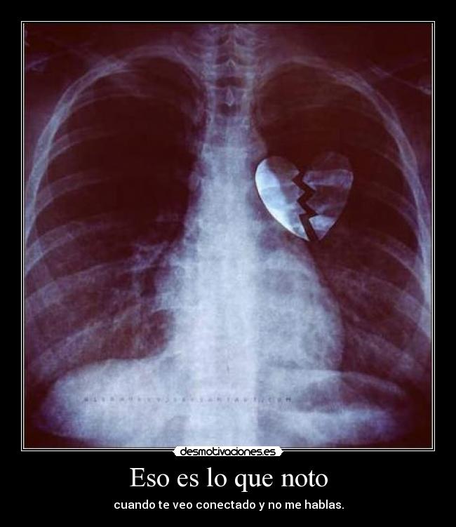 Eso es lo que noto - 