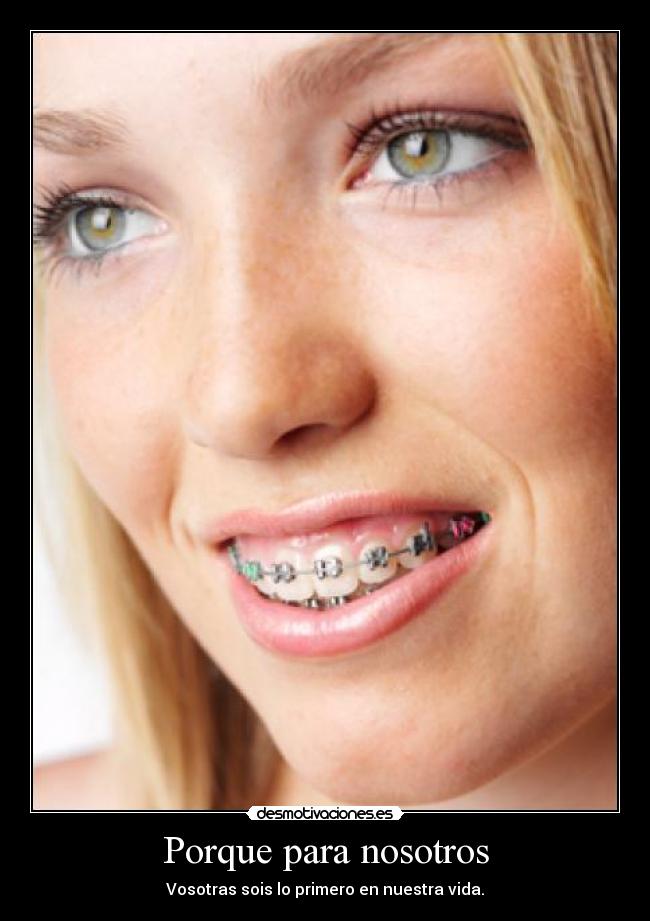 Porque para nosotros - 