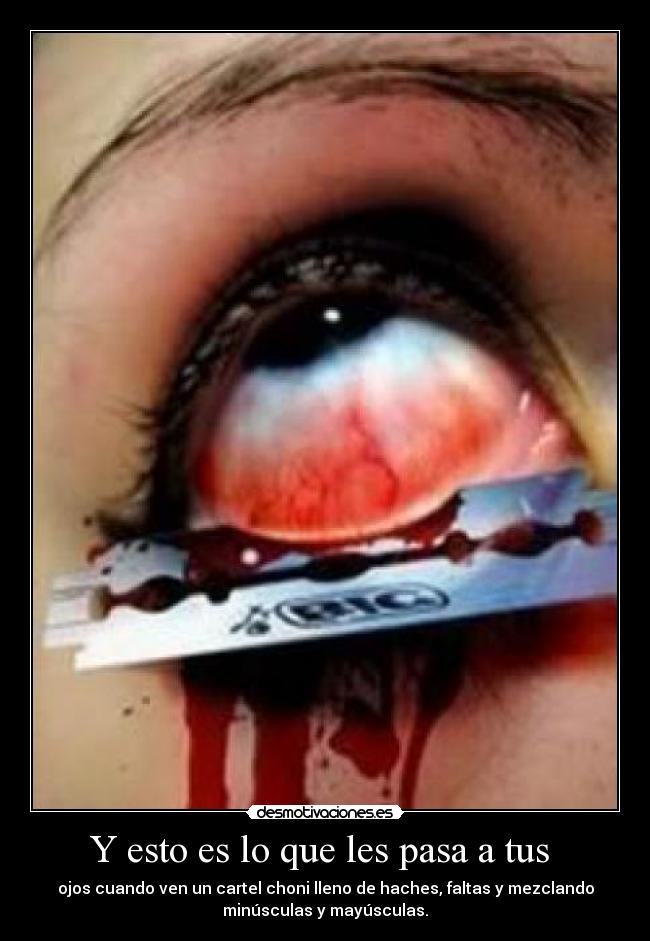 Y esto es lo que les pasa a tus  - 