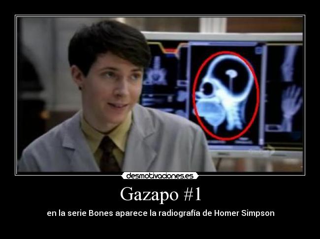 Gazapo #1 - en la serie Bones aparece la radiografía de Homer Simpson
