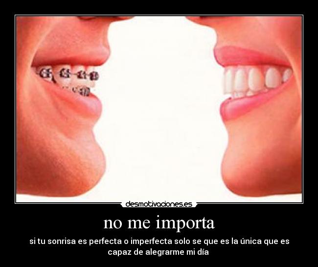 no me importa - si tu sonrisa es perfecta o imperfecta solo se que es la única que es
capaz de alegrarme mi día
