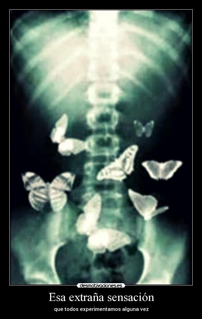 Esa extraña sensación -