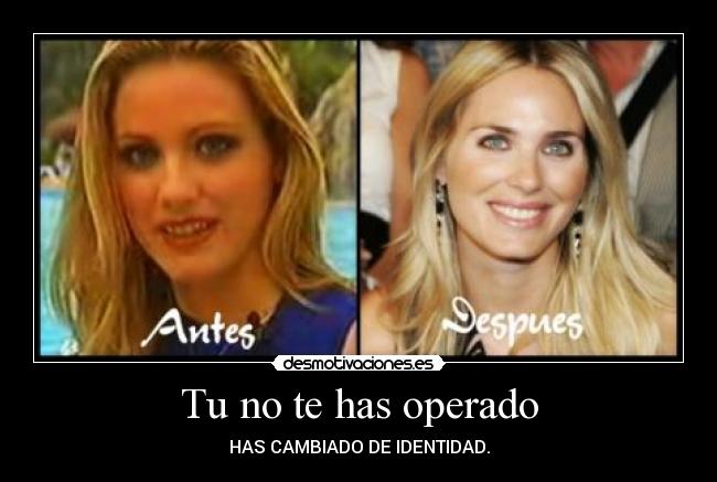 carteles operada identidad cambio antes despues desmotivaciones