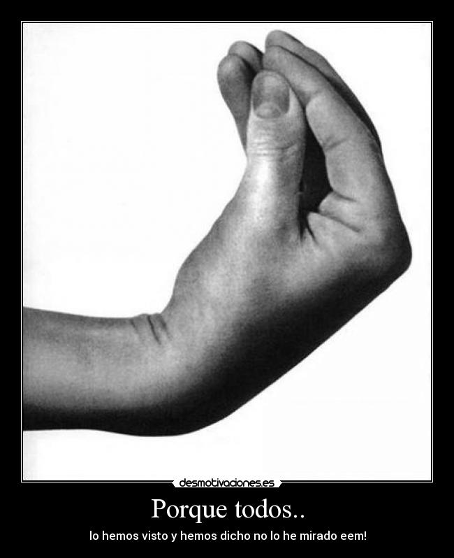 Porque todos.. -