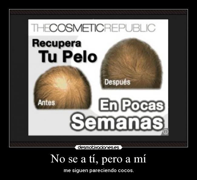 No se a tí, pero a mí -