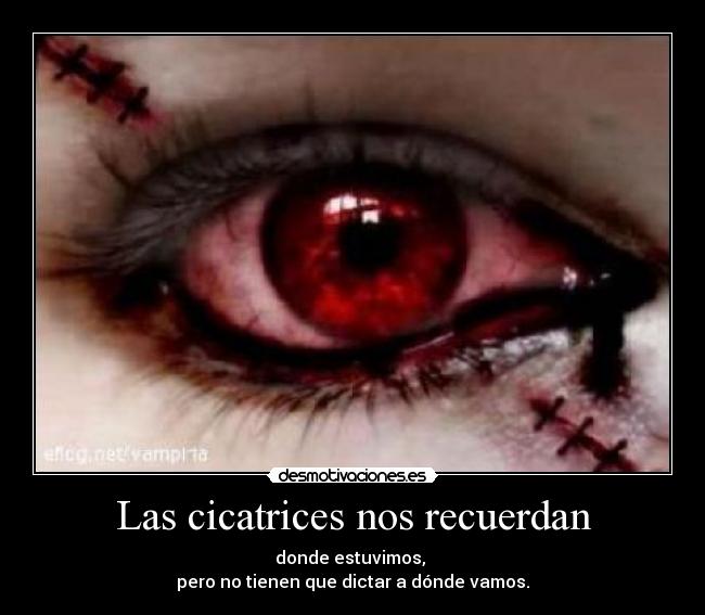 Las cicatrices nos recuerdan -