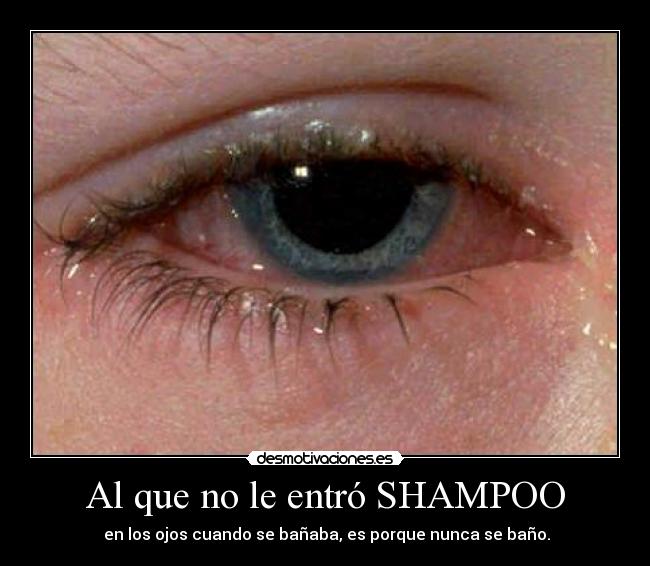 Al que no le entró SHAMPOO - 