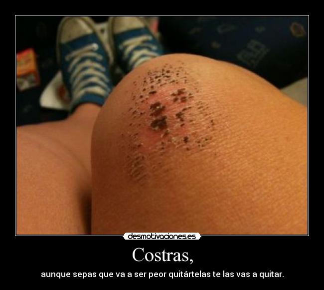 Costras, -