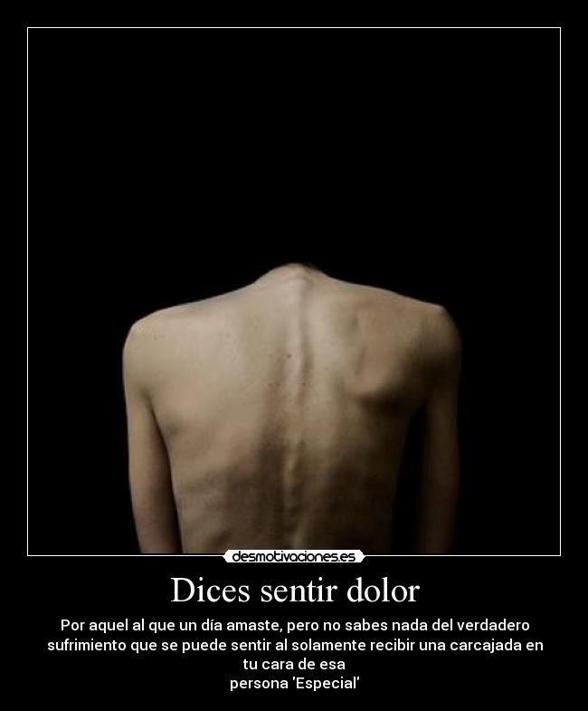 Dices sentir dolor - Por aquel al que un día amaste, pero no sabes nada del verdadero
sufrimiento que se puede sentir al solamente recibir una carcajada en
tu cara de esa
persona Especial