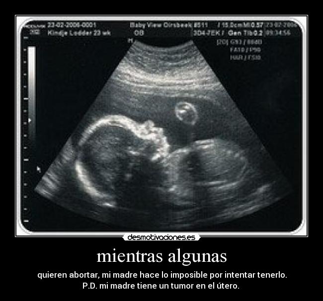 mientras algunas - quieren abortar, mi madre hace lo imposible por intentar tenerlo.
P.D. mi madre tiene un tumor en el útero. 
