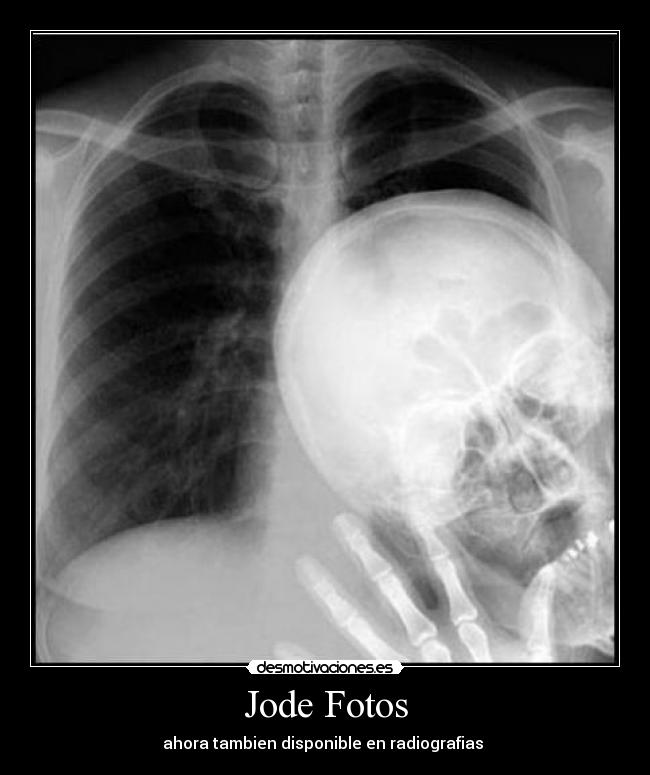 carteles jode fotos radiografias tambien disponible desmotivaciones