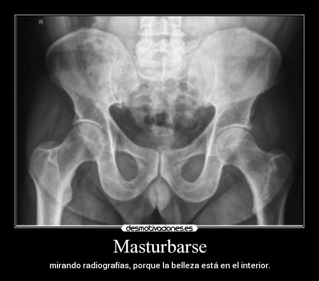 Masturbarse - mirando radiografías, porque la belleza está en el interior.