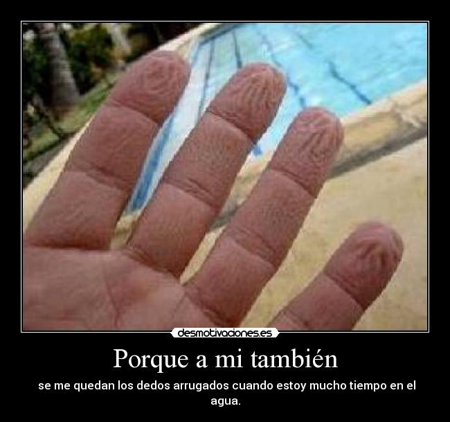 Porque a mi también - se me quedan los dedos arrugados cuando estoy mucho tiempo en el agua.