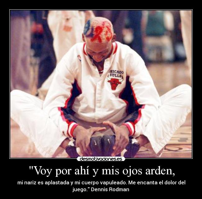 Voy por ahí y mis ojos arden, -