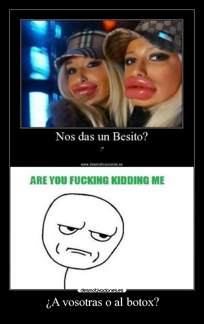 ¿A vosotras o al botox? -