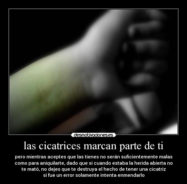 las cicatrices marcan parte de ti -