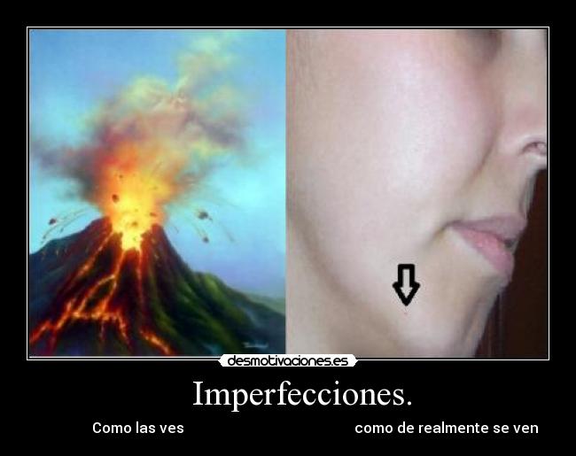    Imperfecciones. -                Como las ves                                                como de realmente se ven