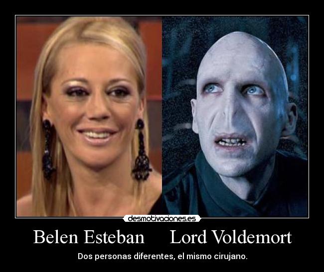 Belen Esteban Lord Voldemort - Dos personas diferentes, el mismo cirujano.