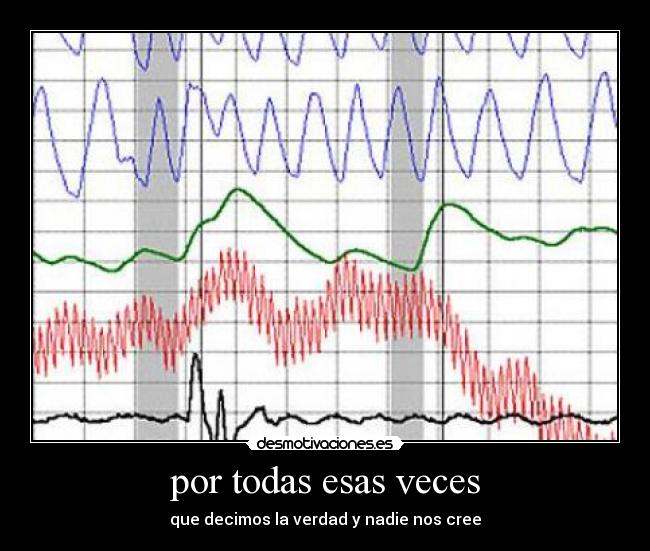 por todas esas veces -