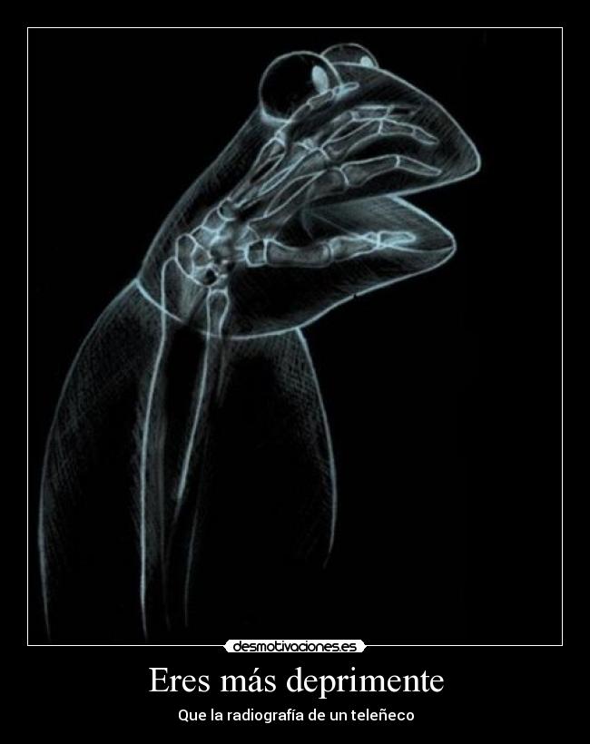 Eres más deprimente -