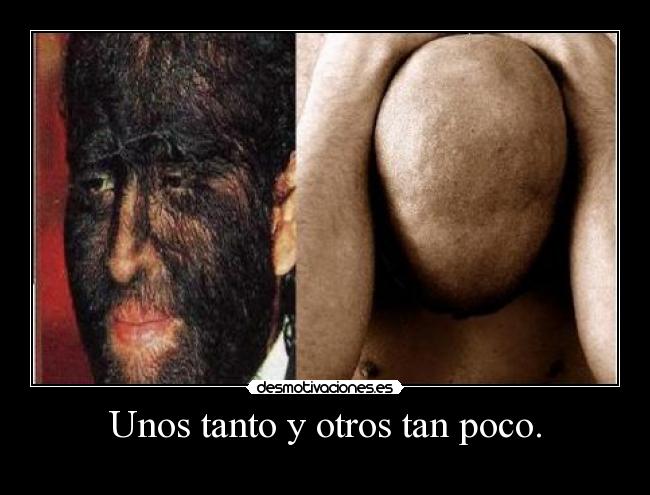 Unos tanto y otros tan poco. - 