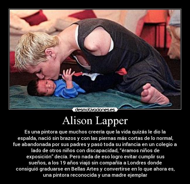 Alison Lapper - Es una pintora que muchos creería que la vida quizás le dio la
espalda, nació sin brazos y con las piernas más cortas de lo normal,
fue abandonada por sus padres y pasó toda su infancia en un colegio a
lado de otros niños con discapacidad, “éramos niños de
exposición” decía. Pero nada de eso logro evitar cumplir sus
sueños, a los 19 años viajó sin compañía a Londres donde
consiguió graduarse en Bellas Artes y convertirse en lo que ahora es,
una pintora reconocida y una madre ejemplar