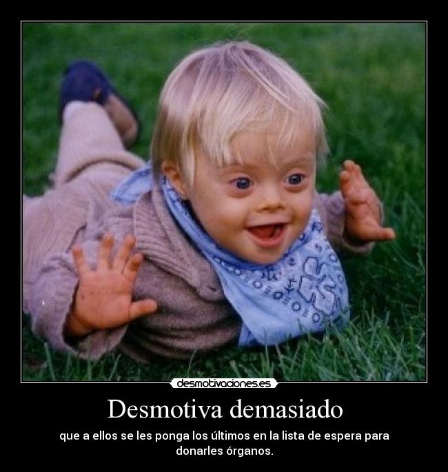 Desmotiva demasiado -