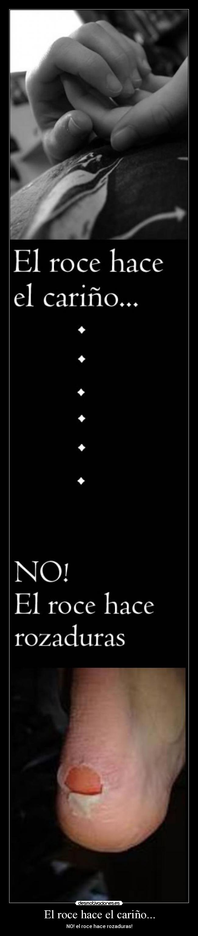 El roce hace el cariño... - NO! el roce hace rozaduras!