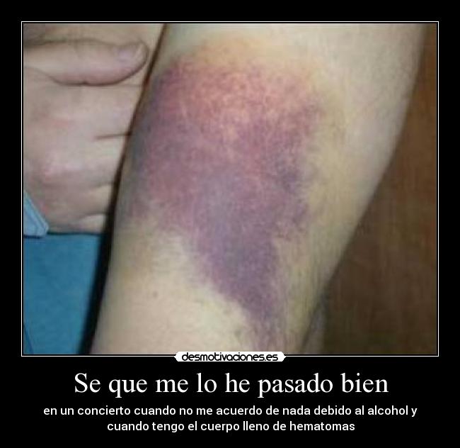 Se que me lo he pasado bien - en un concierto cuando no me acuerdo de nada debido al alcohol y
cuando tengo el cuerpo lleno de hematomas