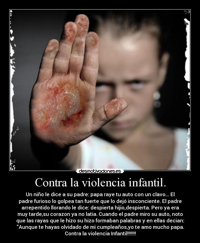 Contra la violencia infantil. -