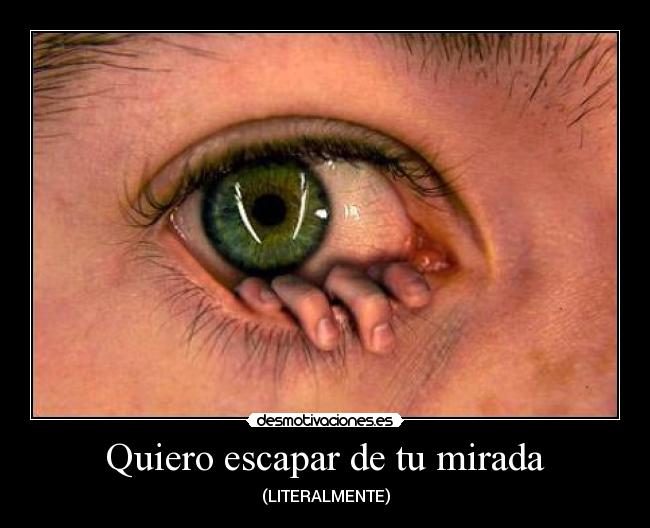 Quiero escapar de tu mirada - (LITERALMENTE)