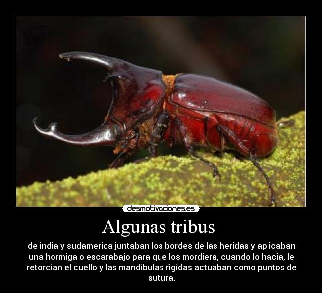 Algunas tribus - de india y sudamerica juntaban los bordes de las heridas y aplicaban
una hormiga o escarabajo para que los mordiera, cuando lo hacia, le
retorcian el cuello y las mandibulas rìgidas actuaban como puntos de
sutura.