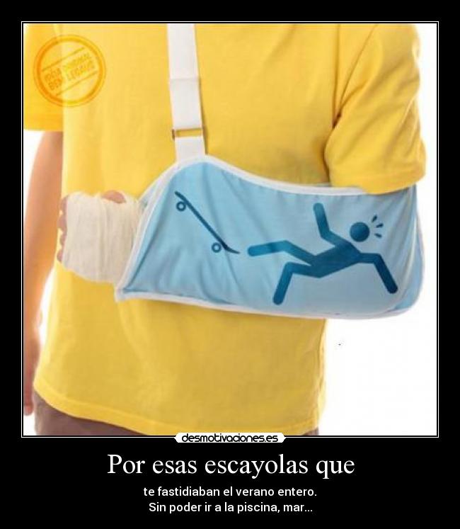 Por esas escayolas que - 