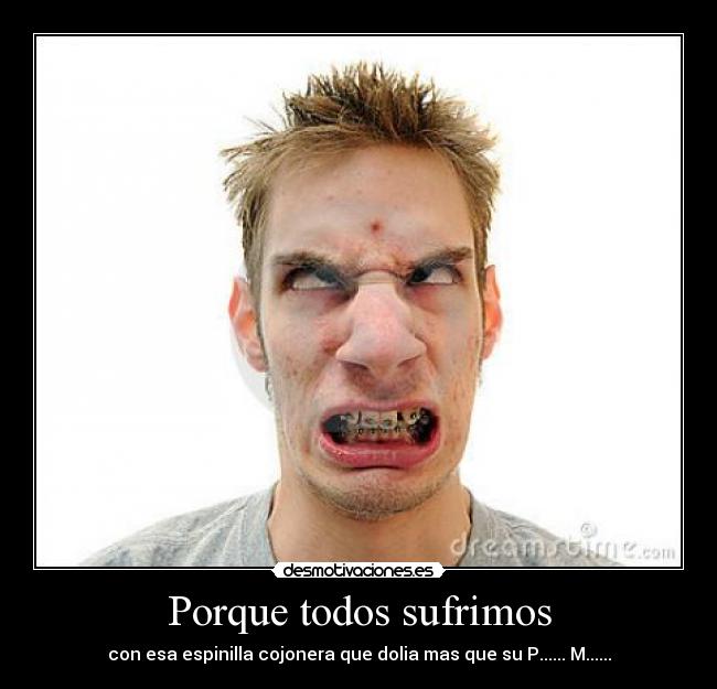 Porque todos sufrimos - con esa espinilla cojonera que dolia mas que su P...... M......