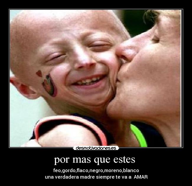 por mas que estes  - feo,gordo,flaco,negro,moreno,blanco
una verdadera madre siempre te va a  AMAR