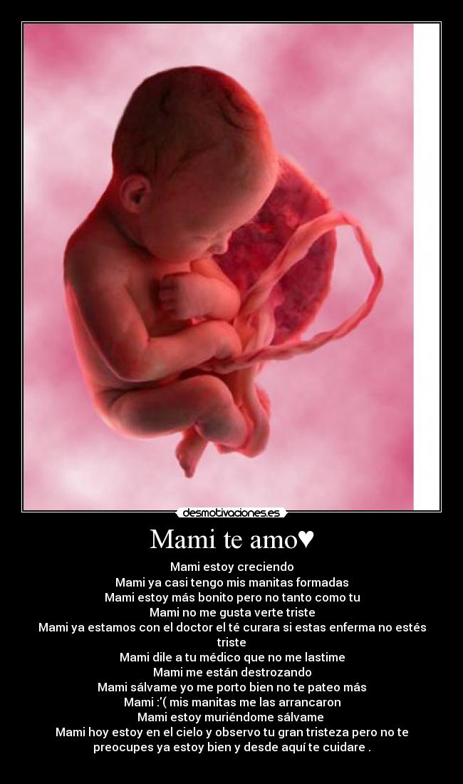 Mami te amo♥ - Mami estoy creciendo
Mami ya casi tengo mis manitas formadas
Mami estoy más bonito pero no tanto como tu
Mami no me gusta verte triste
Mami ya estamos con el doctor el té curara si estas enferma no estés
triste
Mami dile a tu médico que no me lastime
Mami me están destrozando
Mami sálvame yo me porto bien no te pateo más
Mami :( mis manitas me las arrancaron
Mami estoy muriéndome sálvame
Mami hoy estoy en el cielo y observo tu gran tristeza pero no te
preocupes ya estoy bien y desde aquí te cuidare .