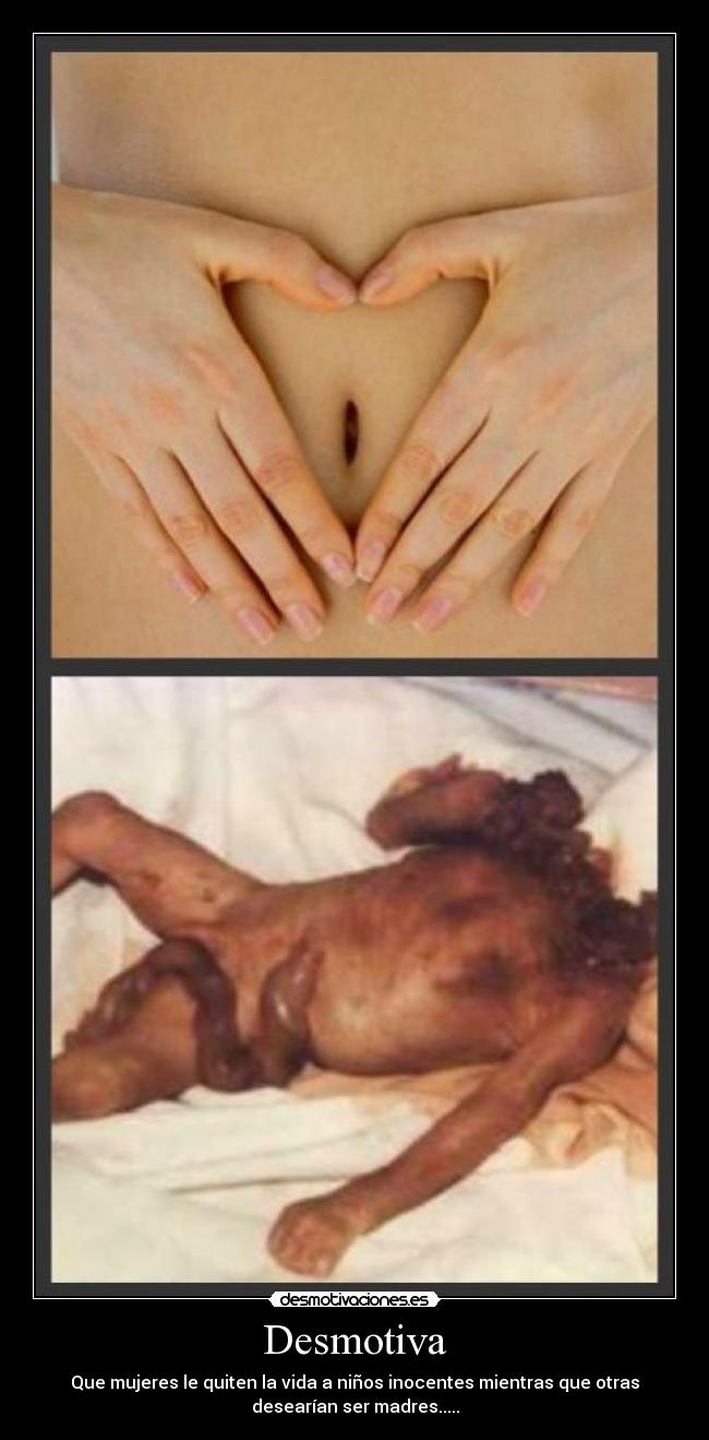 Desmotiva - Que mujeres le quiten la vida a niños inocentes mientras que otras
desearían ser madres.....